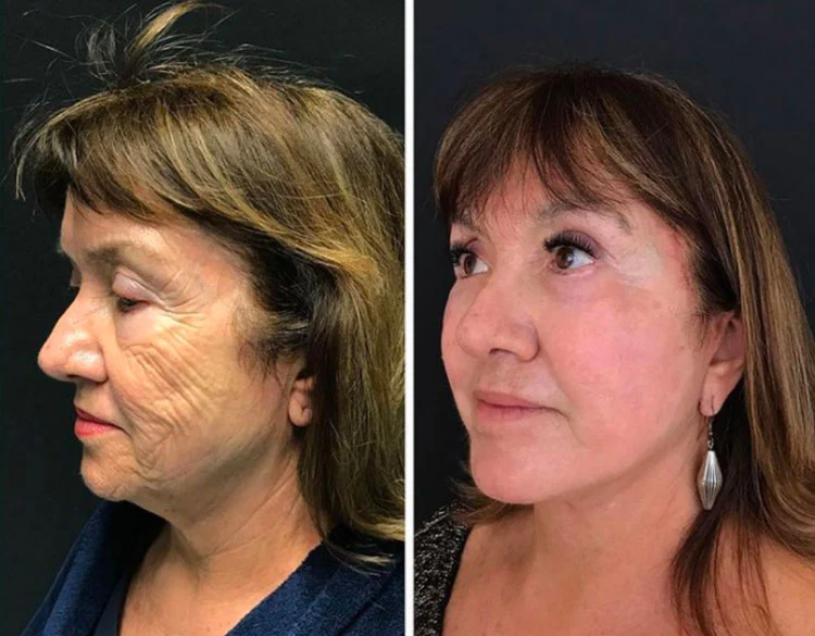 Depoimento de cliente satisfeita com Rosa Amazônica