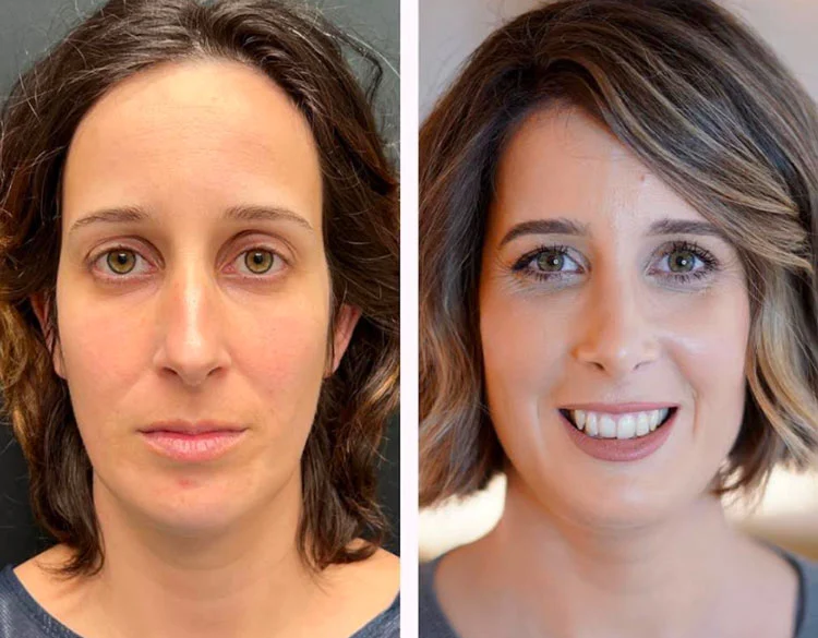 Depoimento de cliente satisfeita com Rosa Amazônica